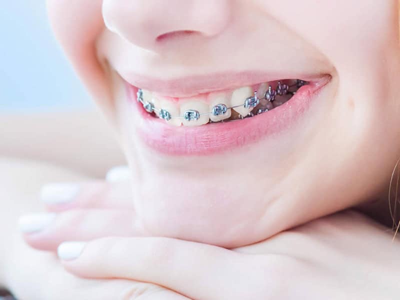 Orthodontics