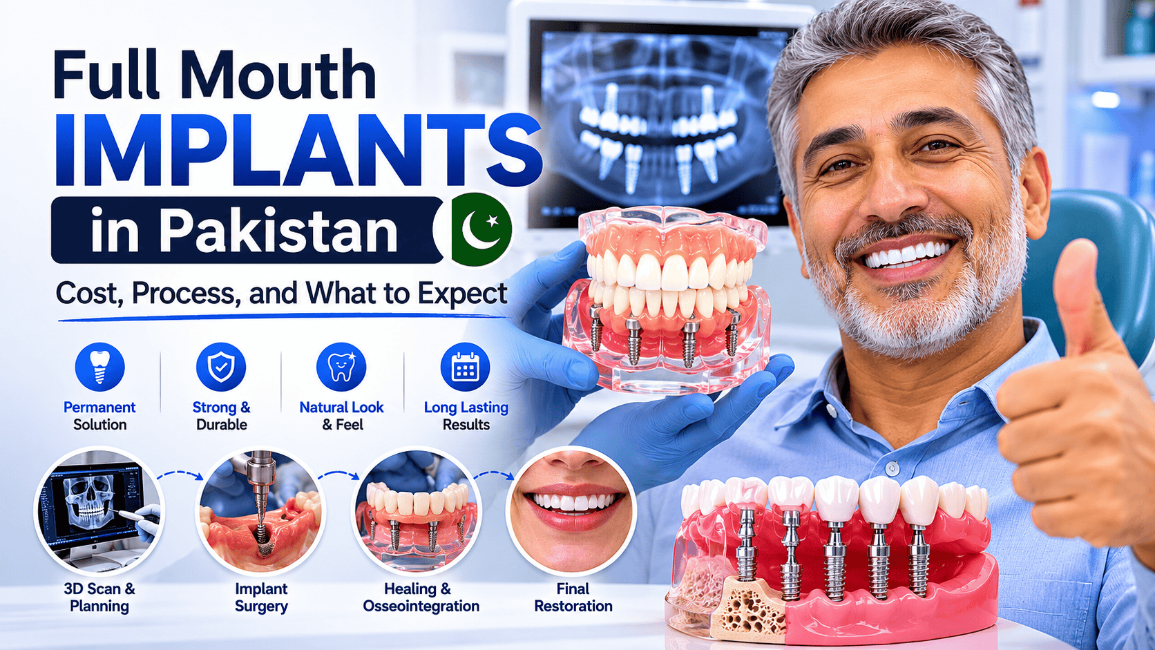 full mouth implants Pakistan affordable all on 4 dental implants best dental implant clinic cost