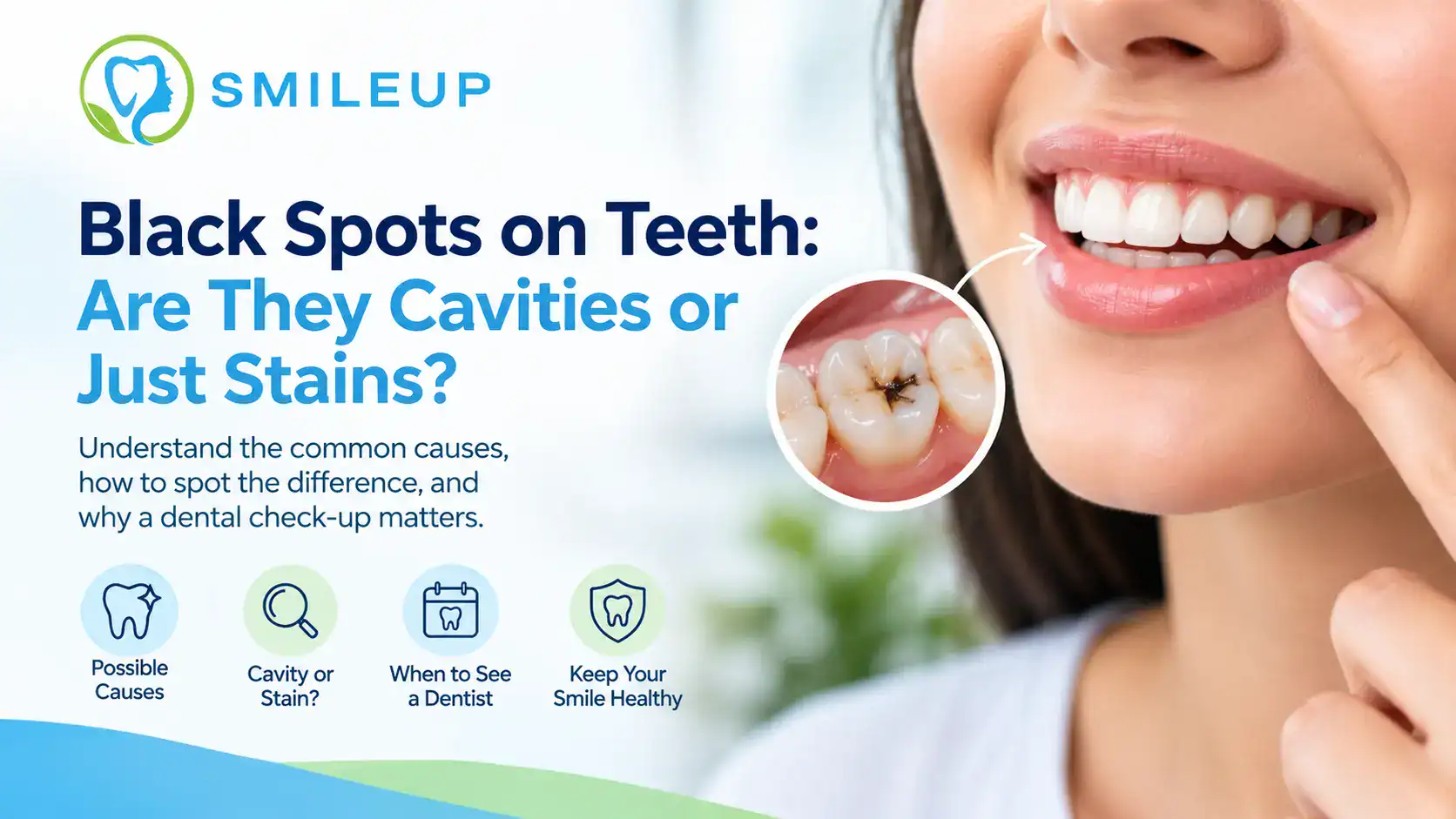 Black Spots on Teeth: Are They Cavities or Just Stains?